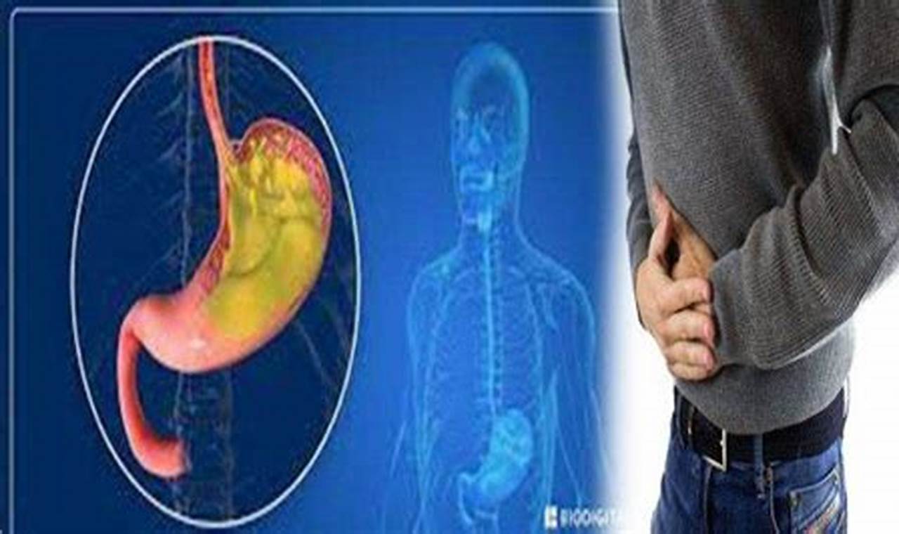 Cara Mengatasi Gerd: Solusi Ampuh Untuk Mengurangi Gejala Asam Lambung Cara Mengatasi Gerd: Solusi Ampuh Untuk Mengurangi Gejala Asam Lambung